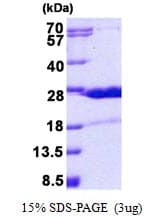 Human HN1 / ARM2 Protein (Recombinant His)