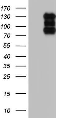 Monoclonal Mouse anti-Human HDAC4 Antibody (clone OTI4D7, WB)