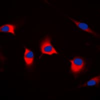 Polyclonal Rabbit anti-Human CDKL4 Antibody (C-Terminus, IHC, IF, WB)