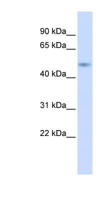ZNF851 / ZBTB44 Antibody (aa180-229)