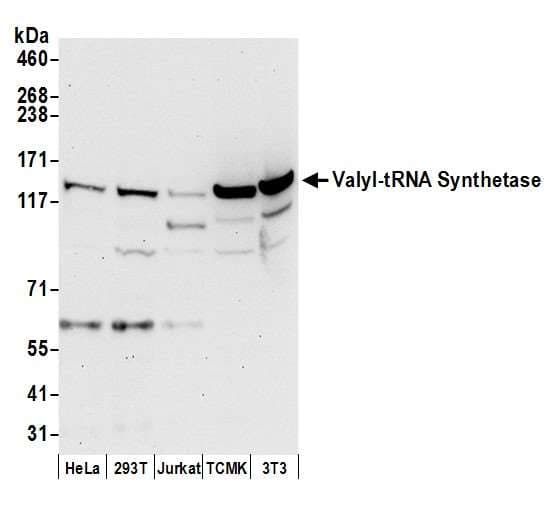VARS / ValRS Antibody (aa1214-1264)