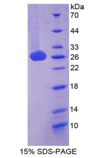 Mouse CD275 / B7-H2 / ICOS Ligand Protein (Recombinant His-T7)