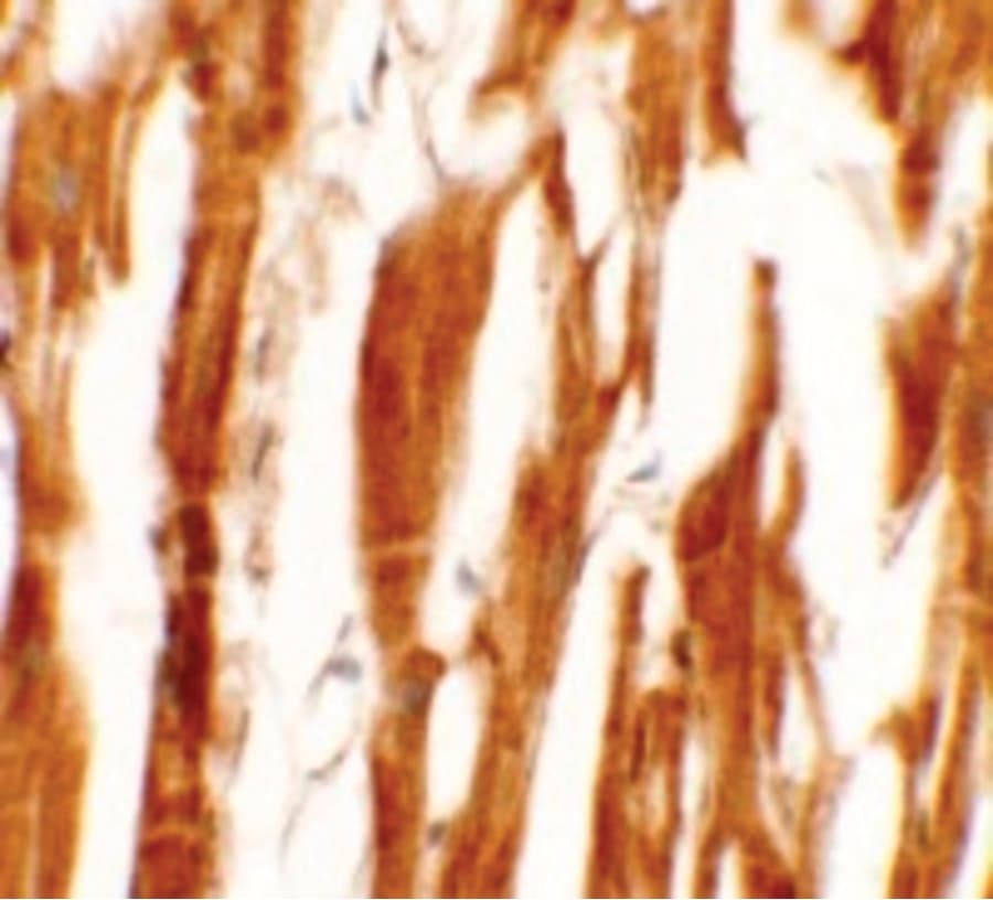 Polyclonal Rabbit anti-Human ESRRB / ERR Beta Antibody (IHC, IF, WB)