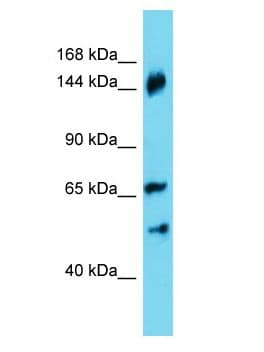 ANKRD18B Antibody (aa481-507)