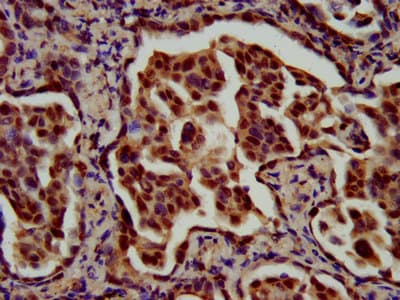 RFX / RFX1 Antibody