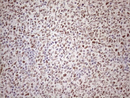 ATF1 Antibody (clone OTI2B4)