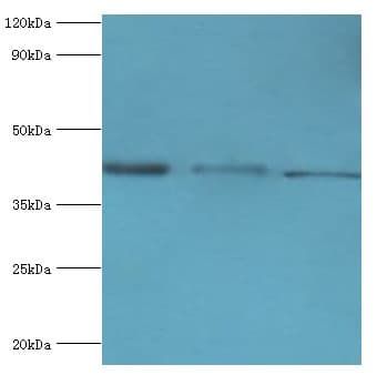 ST8SIA2 / STX Antibody (aa24-160)
