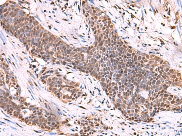 SCCPDH Antibody