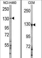 Polyclonal Rabbit anti-Human E4 / UBE4A Antibody (aa1037-1067, IHC, WB)