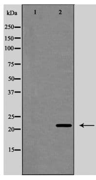 BCL2L11 / BIM Antibody