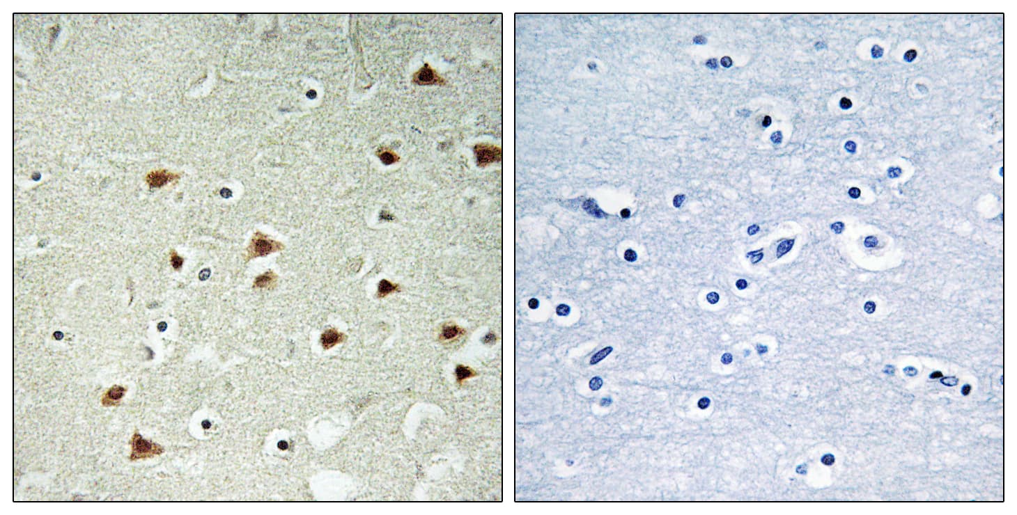 ABHD14B Antibody (aa161-210)