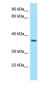 RDH8 Antibody (aa131-180)