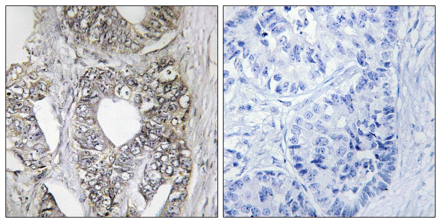 MAPK10 / JNK3 Antibody (p185)