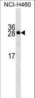 APCS / Serum Amyloid P / SAP Antibody