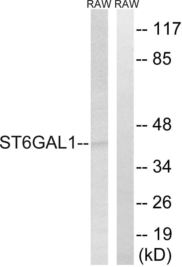 ST6GAL1 / CD75 Antibody