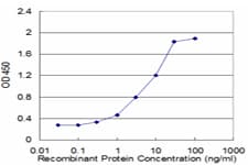 FABP1 / L-FABP Antibody (clone 4G5)