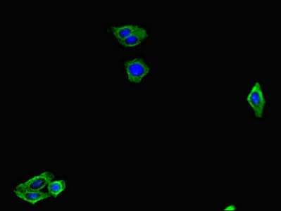 Polyclonal Rabbit anti-Human GMIP Antibody (IHC, IF)