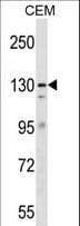 ERCC5 / XPG Antibody (aa1151-1178)
