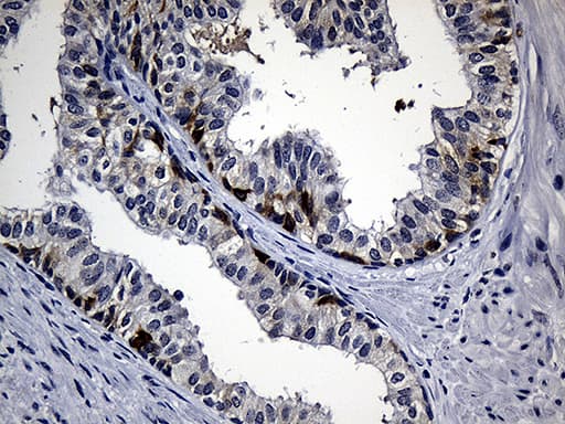 Monoclonal Mouse anti-Human R1 / RRM1 Antibody (clone OTI6G8, aa541-792, IHC, WB)