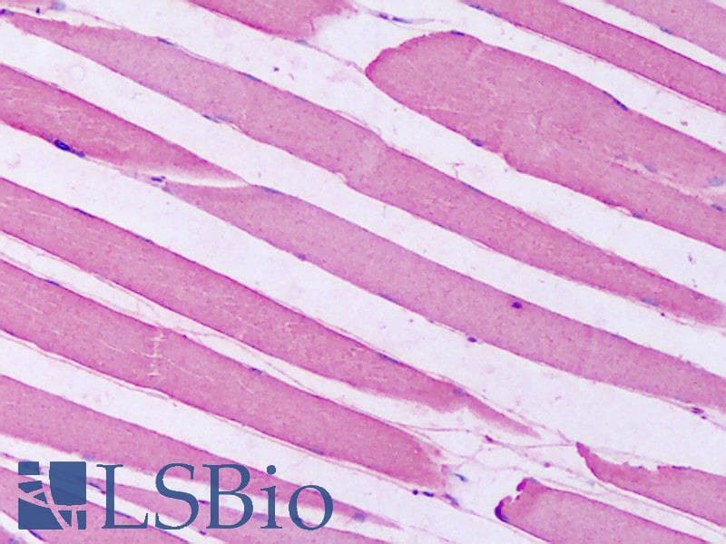 IHC-plus™ Polyclonal Rabbit anti-Human HTR7 / 5HT7 Receptor Antibody (C-Terminus, IHC, IF)