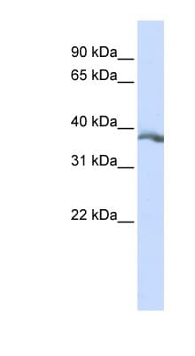 Polyclonal Rabbit anti-Human EDA / Ectodysplasin A Antibody (aa252-301, WB)