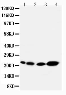 Polyclonal Rabbit anti-Human CAV2 / Caveolin 2 Antibody (aa1-17, IHC, WB)