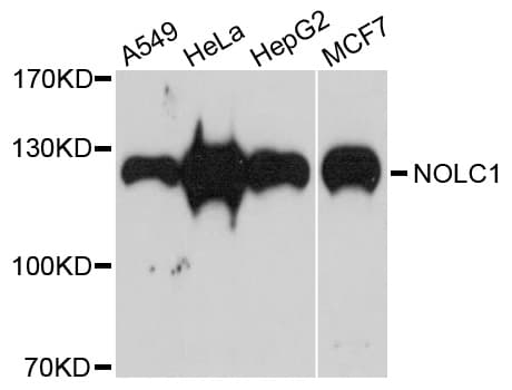 NOLC1 Antibody
