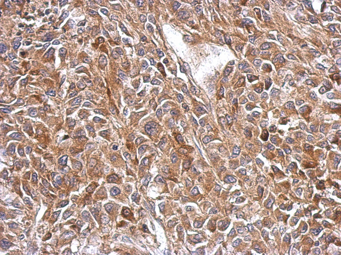 Polyclonal Rabbit anti-Human OXSM / KS Antibody (IHC, WB)