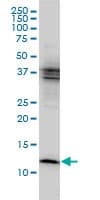 IHC-plus™ Monoclonal Mouse anti-Human CSTB / Cystatin B / Stefin B Antibody (clone M1-C1, IHC, WB)