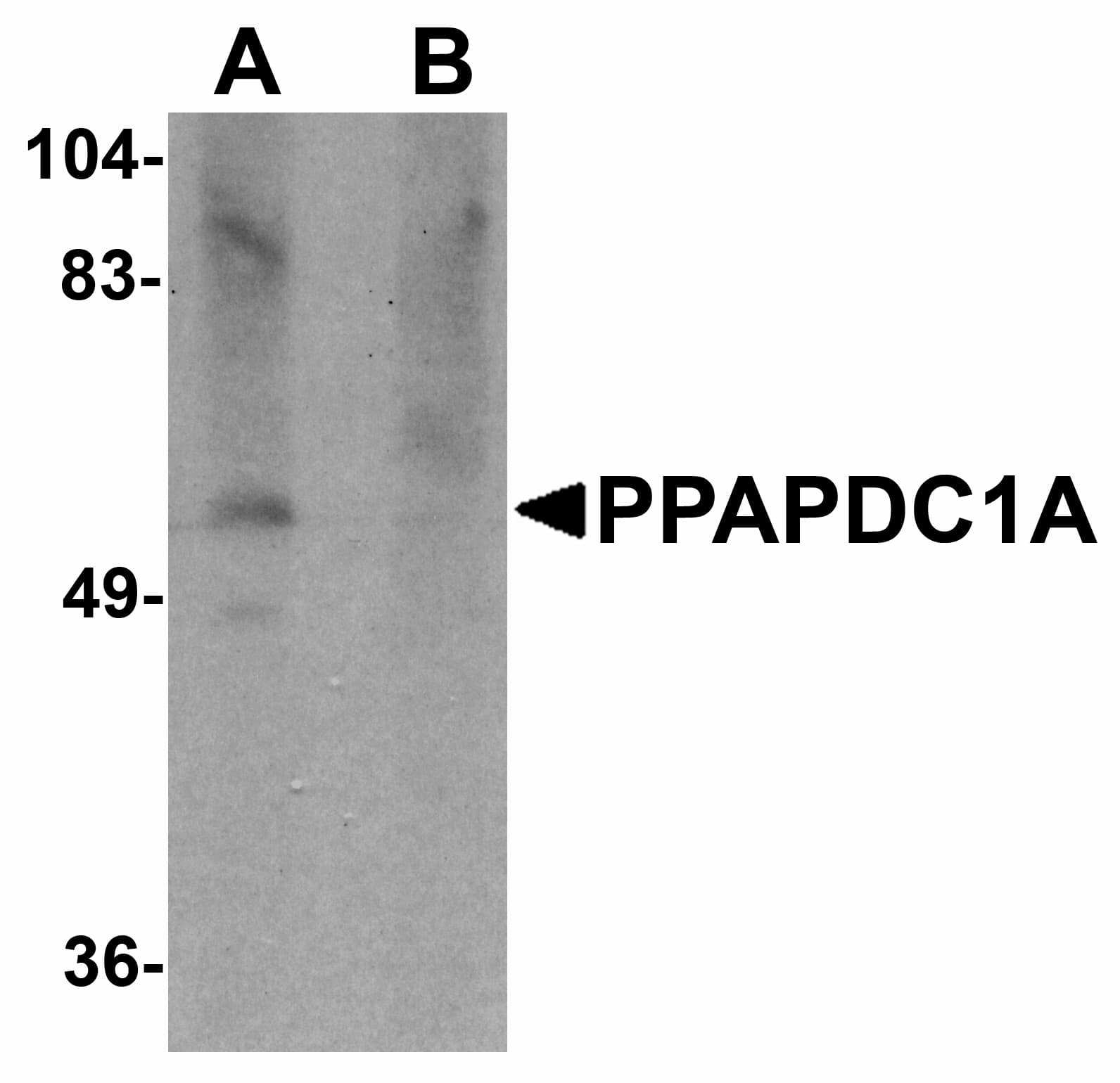 Polyclonal Rabbit anti-Human PPAPDC1A / DPPL2 Antibody (IF, WB)