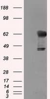 IHC-plus™ Monoclonal Mouse anti-Human TKT / Transketolase Antibody (clone 5H3, IHC, IF, WB)