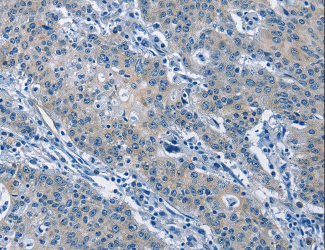 GAS2 Antibody