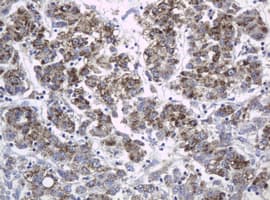 c-Kit / CD117 Antibody (aa546-976, clone OTI1E2)