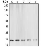 CASP6 / Caspase 6 Antibody (Internal)