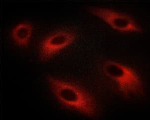 PRKCZ / PKC-Zeta Antibody (phospho-Thr410)