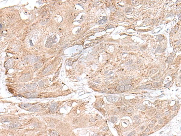SNRNP25 Antibody