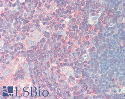 IHC-plus™ IPAF / NLRC4 Antibody