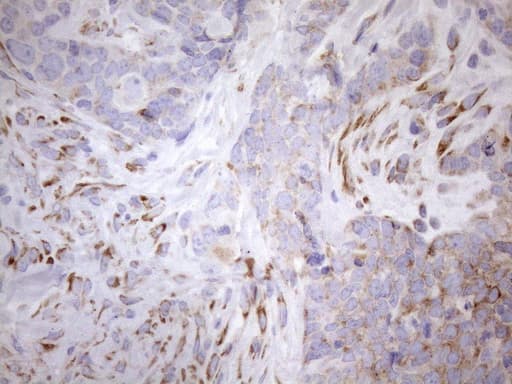 Monoclonal Mouse anti-Human NT5E / eNT / CD73 Antibody (clone OTI1G2, aa119-232, IHC, WB)