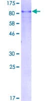 Human PLK1 / PLK-1 Protein (Recombinant GST)
