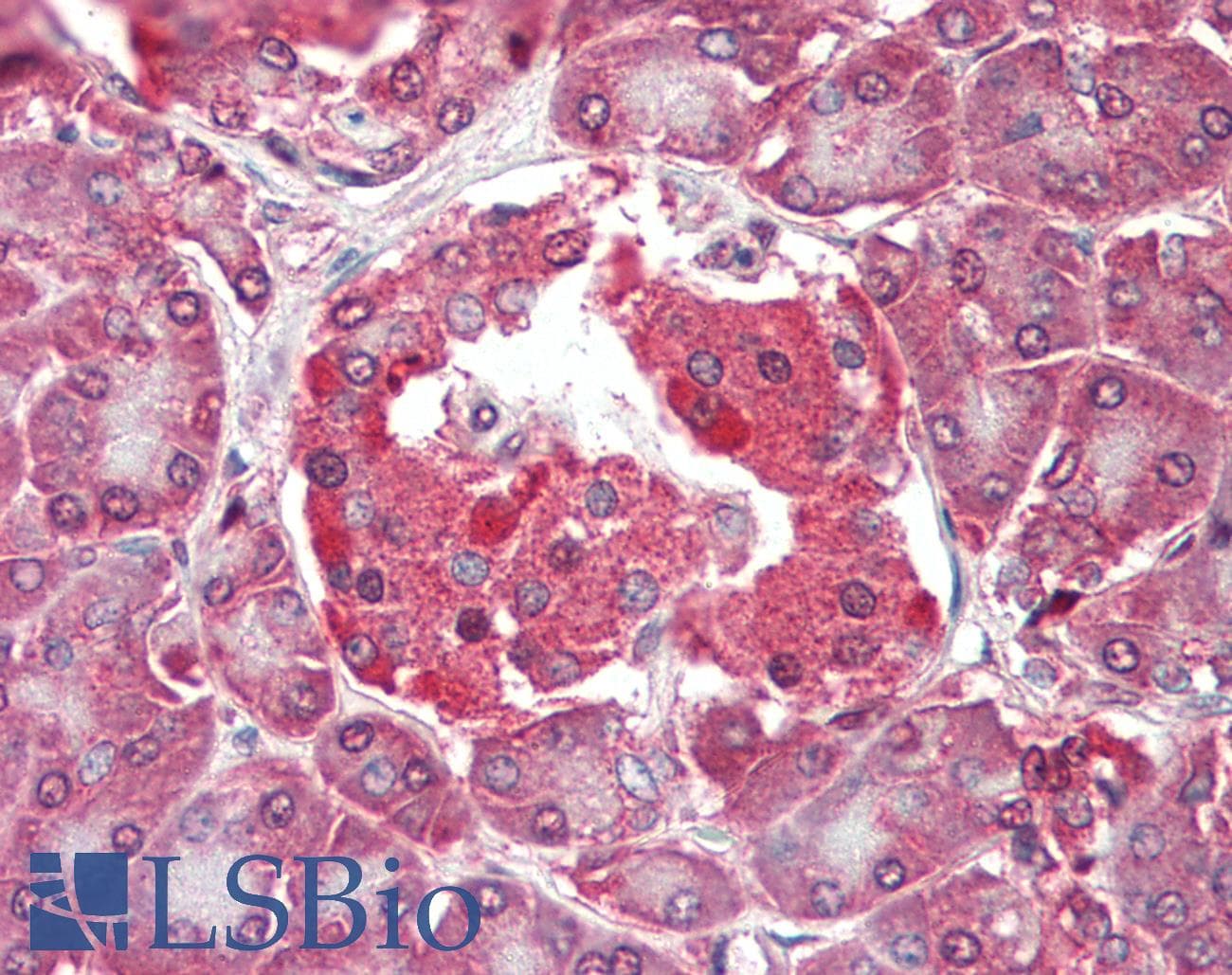 IHC-plus™ RASD2 Antibody