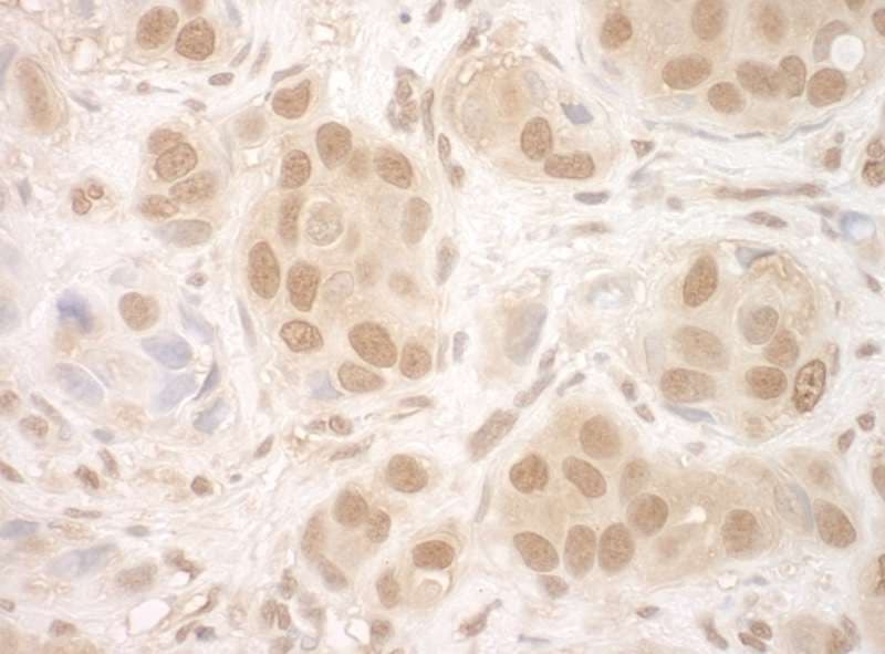 Polyclonal Rabbit anti-Human NCBP2 / CBP20 Antibody (aa1-50, IHC)