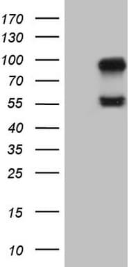 ACVR2 / ACVR2A Antibody (aa214-513, clone OTI8C7)