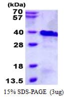Human RNF4 Protein (Recombinant His)