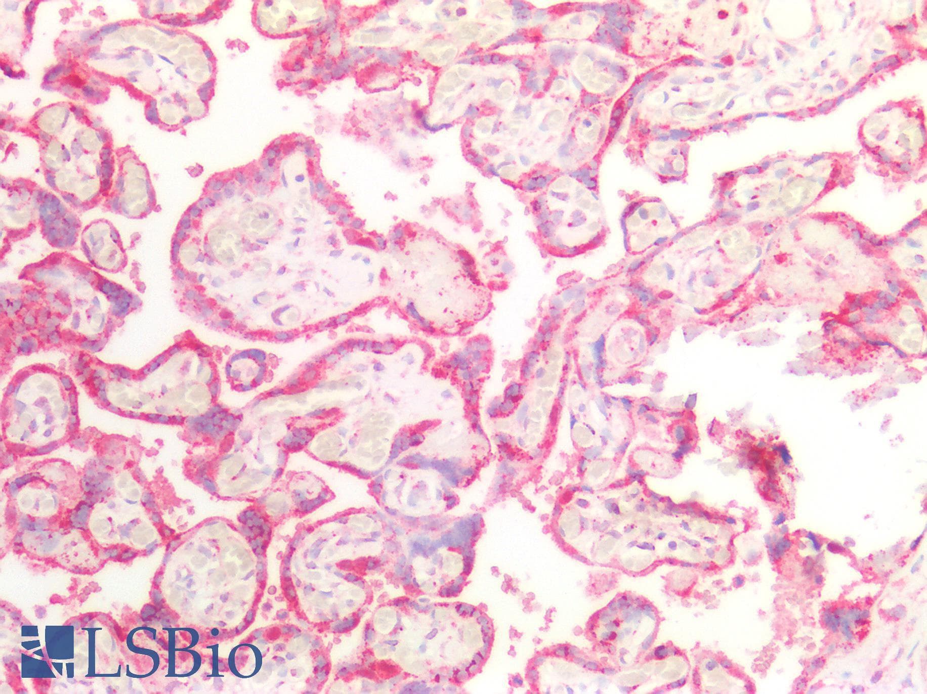 IHC-plus™ RAB5A / RAB5 Antibody (aa182-211)