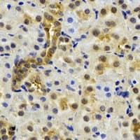 NAA50 / NAT13 / SAN Antibody
