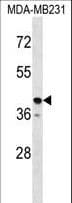 Polyclonal Rabbit anti-Human TAS2R31 / T2R31 Antibody (aa280-309, WB)