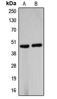 Polyclonal Rabbit anti-Human B4GALT5 Antibody (C-Terminus, WB)