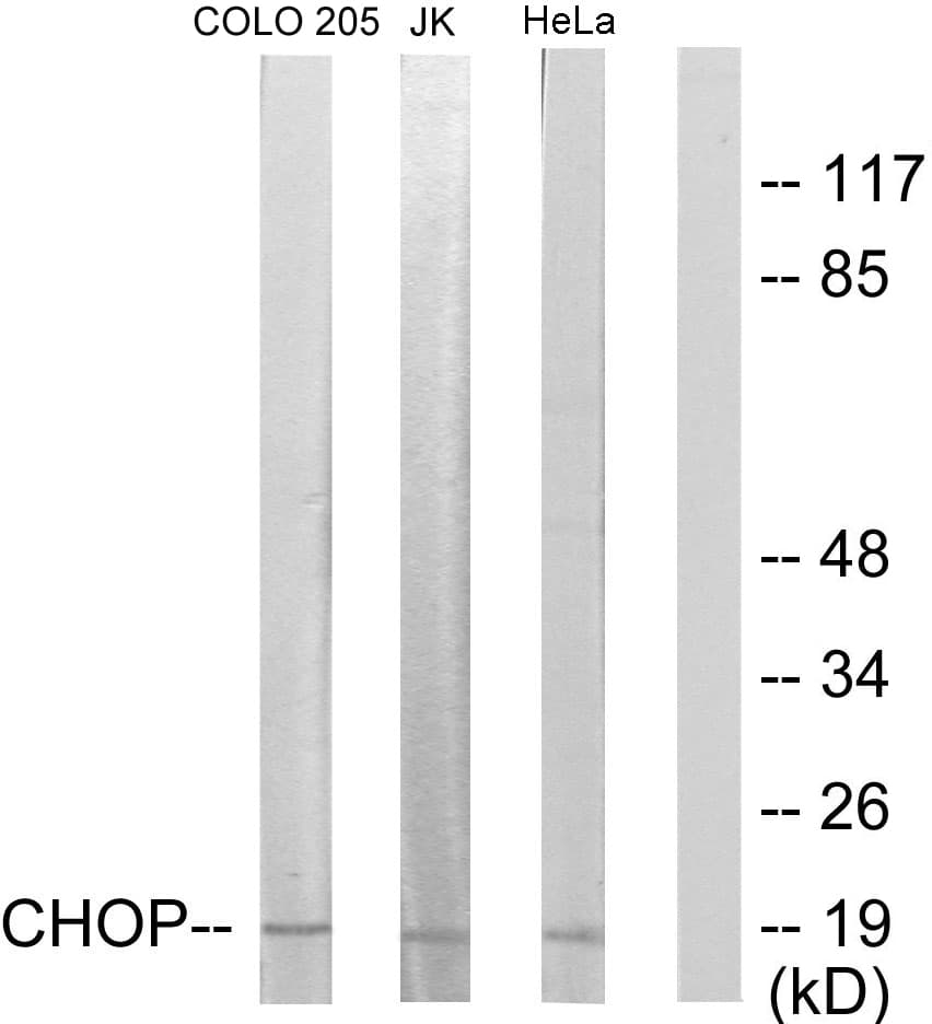 DDIT3 / CHOP Antibody (aa15-64)