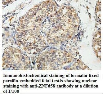 ZNF658 Antibody (aa142-435)