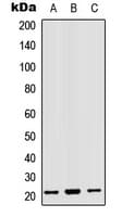 MRPL18 Antibody (N-Terminus)